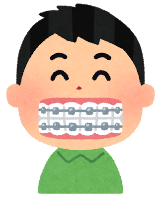 矯正中の歯